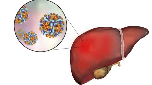 হেপাটাইটিসে প্রতি ৩০ সেকেন্ডে একজনের মৃত্যু, টিকার বিকল্প নেই 