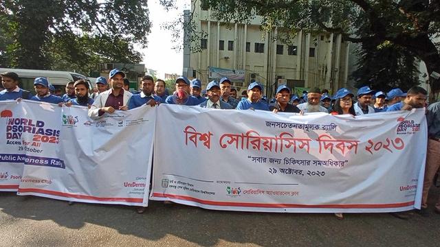 চর্মরোগ সোরিয়াসিসের সর্বাধুনিক চিকিৎসা বিএসএমএমইউয়ে : ভিসি