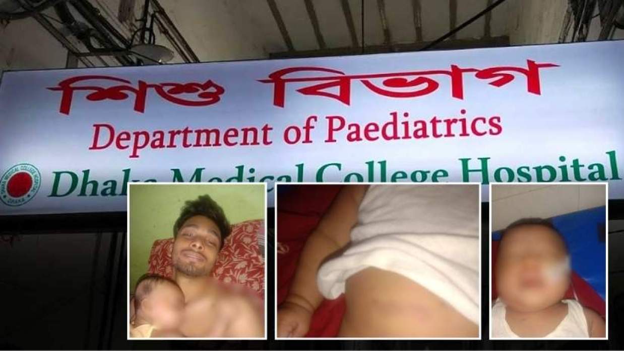 বাবার হাতে নির্যাতন: ঢামেকে চিকিৎসাধীন ২ মাসের সেই শিশুর মৃত্যু